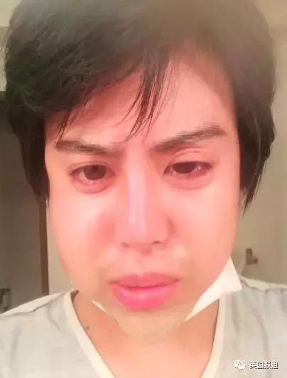 日本男子花费200万整容变成狗,日本整容小哥