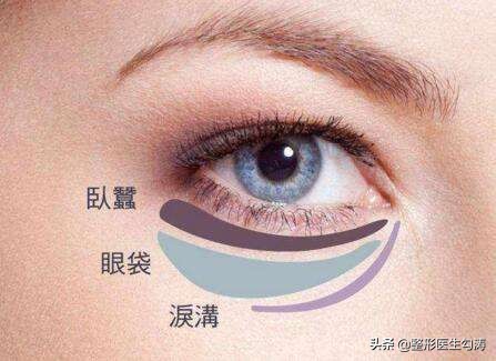 从“半个喜剧”到“寄生虫”看男人的眼袋