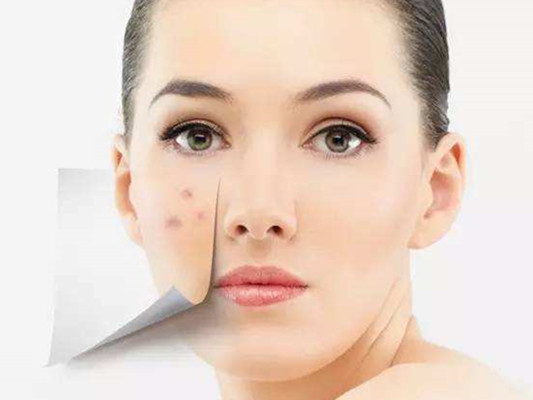 额头长又肿又痛的痘痘怎么办,额头长痘用什么才能缓解压力