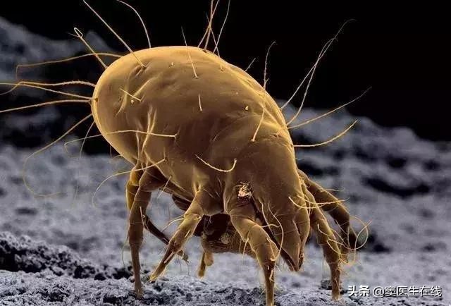 鼻子上挤出的白色条状物怎么去除,鼻子挤出来的白色条状怎么去干净