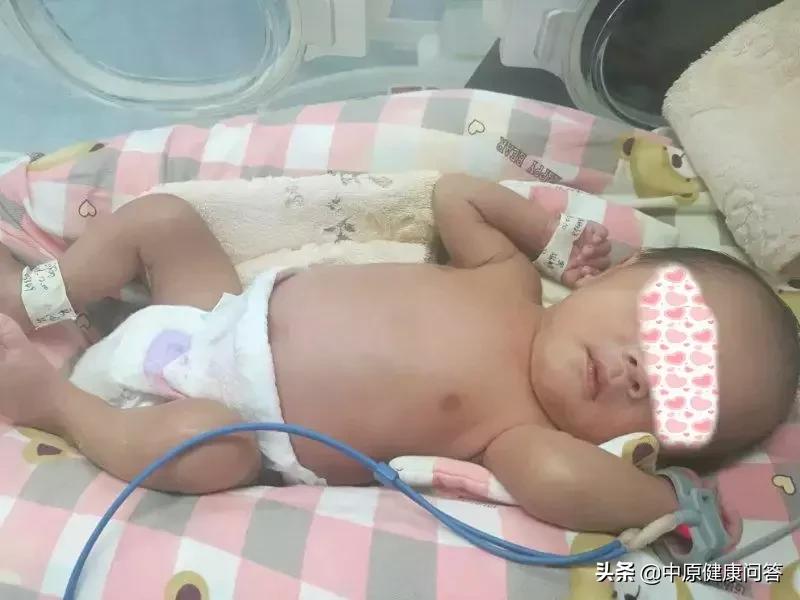 孩子一出生就进重症监护室,刚出生的婴儿在重症监护室9天