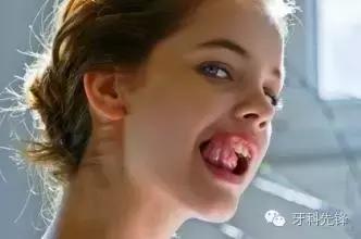 洗牙每年洗一次对牙齿好吗,多久洗一次牙为好洗牙多少钱