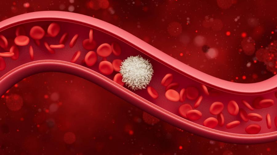 肌肉酸痛乳酸堆积会膝盖痛吗,肌肉酸痛堆积