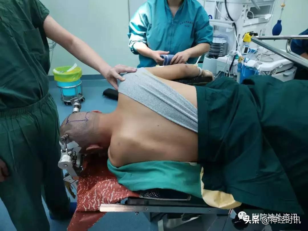 松果体占位怎样治疗,松果体区占位看什么科室