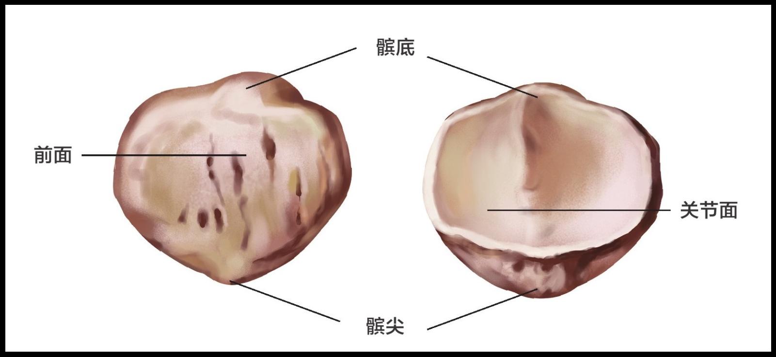 年轻人髌骨软化能不能恢复,年轻人的髌骨软化症是残废了吗
