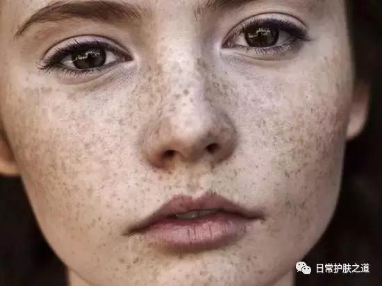 美白淡斑最快最好的方法,美白淡斑的最好方法