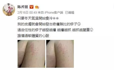 怎么区分湿疹和麻疹,怎么分清湿疹和荨麻疹