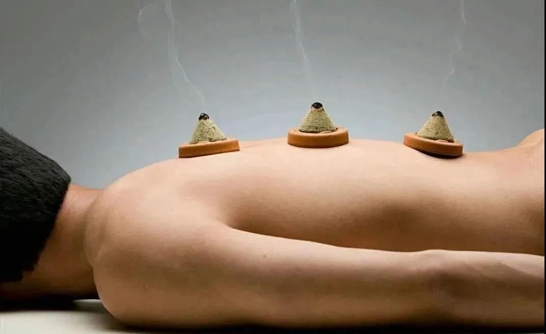 三伏灸三伏,三伏灸跟艾灸有什么不一样