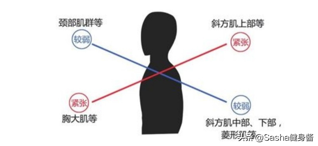 脖颈前伸腰背痛，都是探颈惹的祸，睡前做两个动作，改善探颈问题