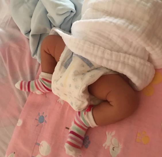 宝宝拉肚子后吃什么养肠胃,宝宝拉肚子需要家长留心吗