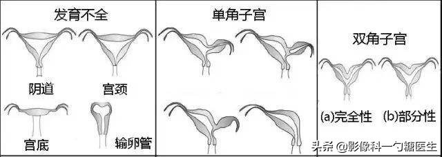 从14岁到17岁,从14岁到22岁