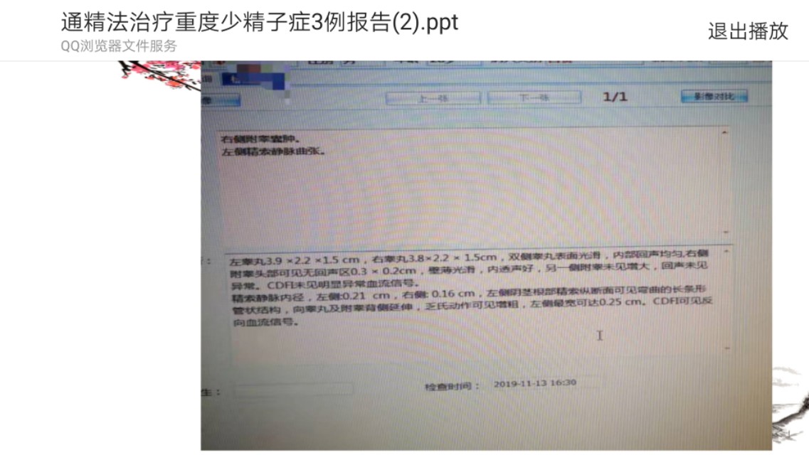 中药治疗少精症,精子少用什么中药