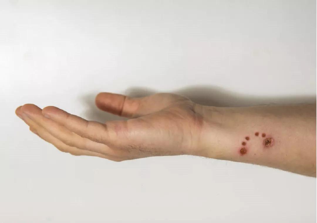 得了狂犬病但没有发作有救吗,得狂犬病的猫和狗