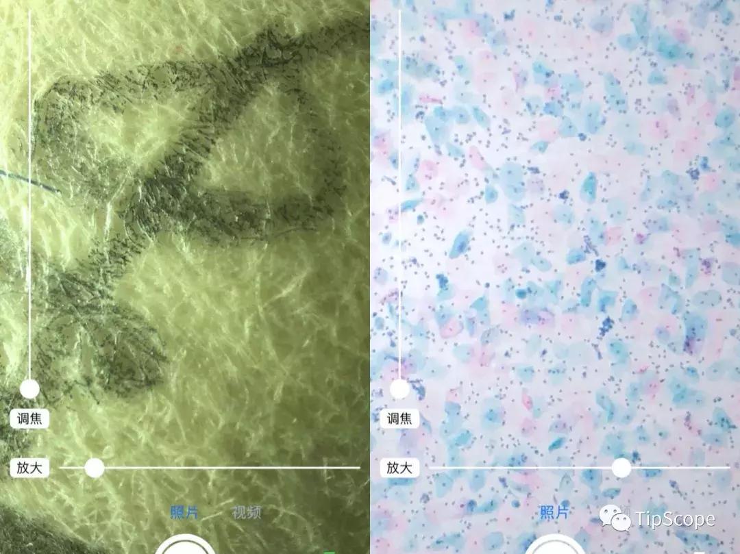 tipscope便携式手机显微镜,送给孩子的科学玩具