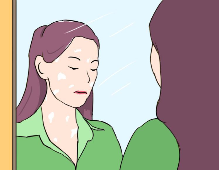 白癜风是常见的皮肤病吗,白癜风是很严重的皮肤病吗