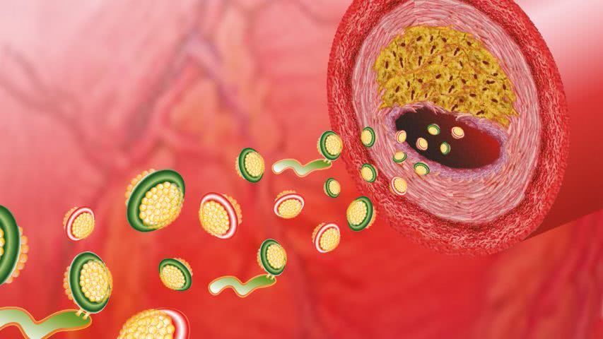 甲减甲亢性心脏病,甲减性心脏病诊断