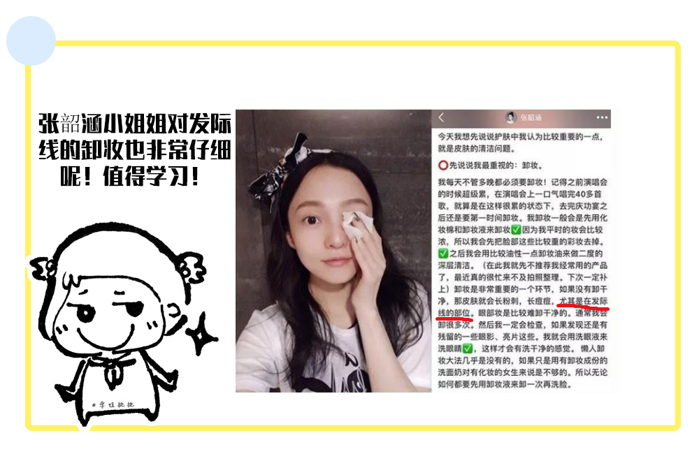 扎头发发际线高怎样修刘海,扎头发简单好看保护发际线