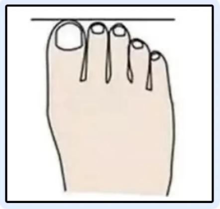 磨脚鞋不合脚,磨脚是因为鞋小吗