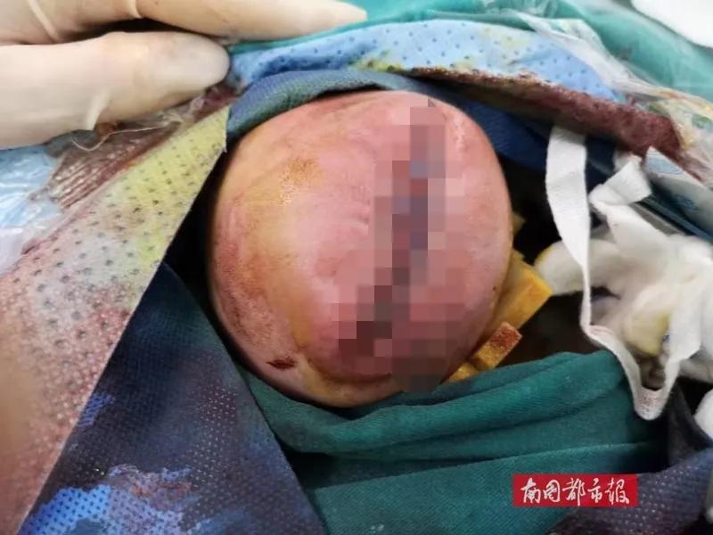 心疼生完二胎的妈妈,心疼妈妈生产的宝宝