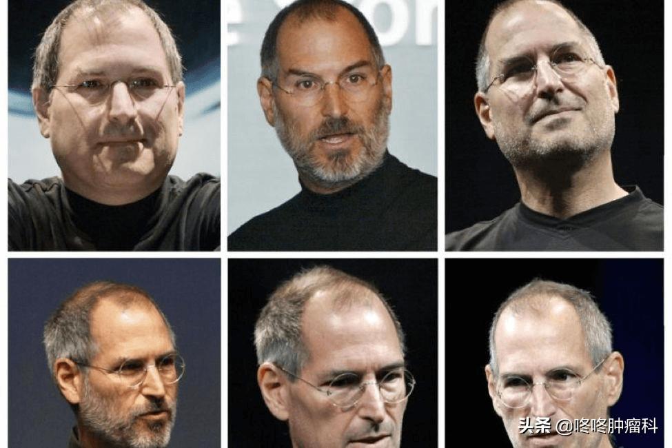 癌症恶病质死亡前特征,恶病质属于癌症吗