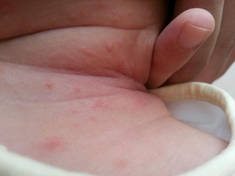 “满月照”有多坑娃，别看宝宝不哭不闹，ta可能正在默默遭罪