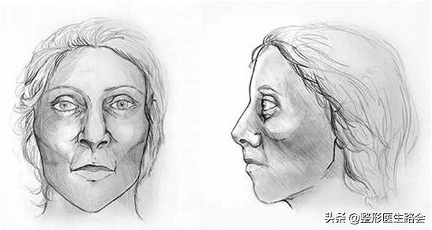 颧骨高到底需不需要整容,颧骨高到底要不要磨骨