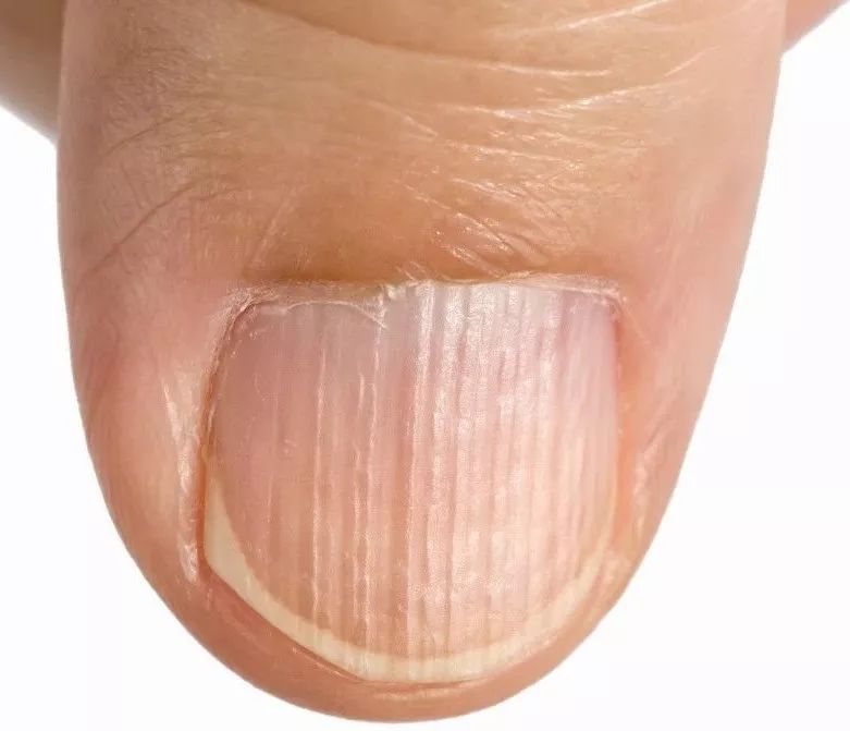 从医学角度，解读手相的秘密