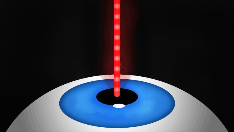 激光治疗近视眼手术十大危害,近视眼激光手术有什么风险和危害