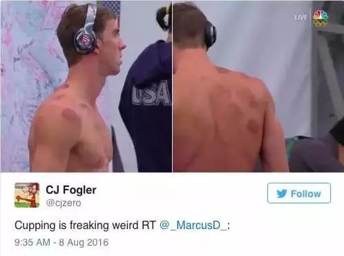 蚊帐成天价抢手货，拔罐变灵丹妙药，在外国人眼里，中国这么牛