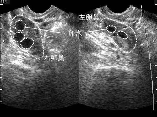 夫妻去医院检查不孕不育,男人检查不孕不育多少钱