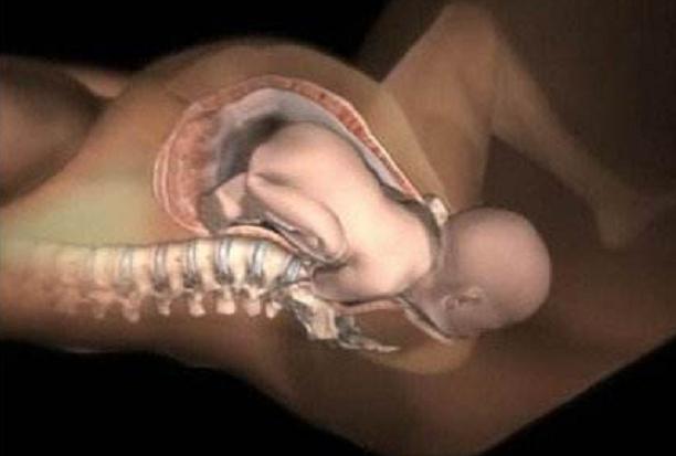 开十指以后还会有宫缩吗,开十指还能愈合吗