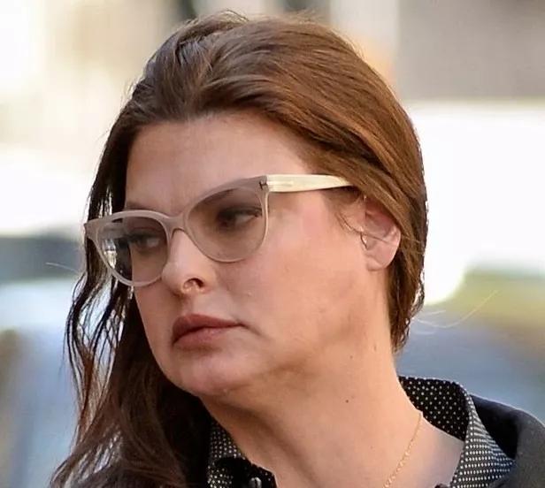 顶流女星整容后遗症,顶流整容失败