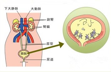 尿液浑浊是什么原因引起的,尿液浑浊和肾有关吗