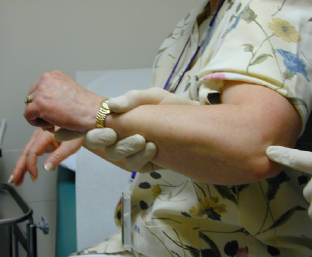 胳膊肘疼俗称网球肘怎么止痛,胳膊肘筋疼不敢伸直挂什么科