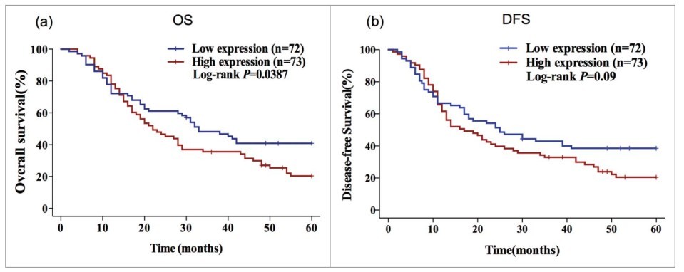 华西食管鳞状细胞癌专家,食道中分化鳞状细胞癌预后