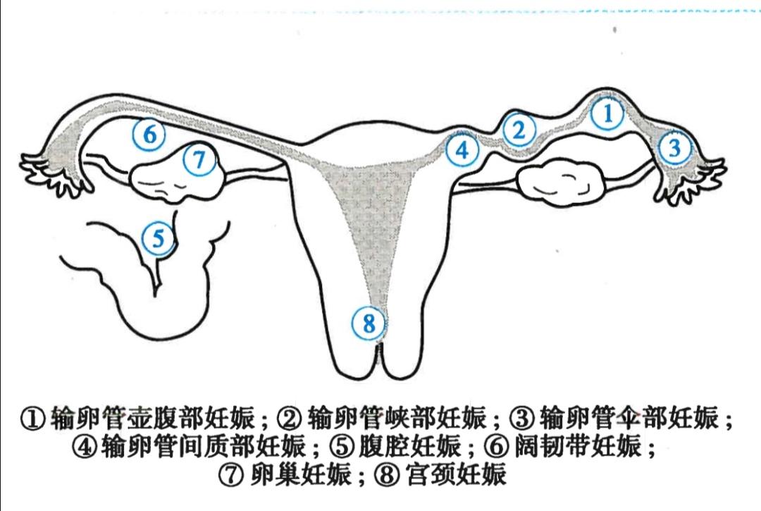 生死营救女子,生死营救女孩完整版