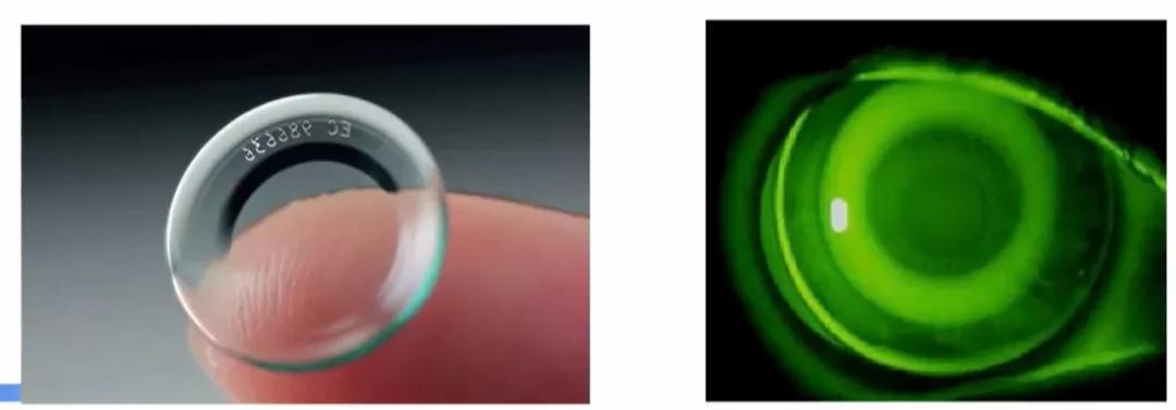 小孩假近视家长怎么办,孩子近视家长怎么调整心态