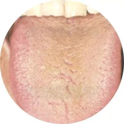 体寒体湿,体寒湿寒湿热有区别吗