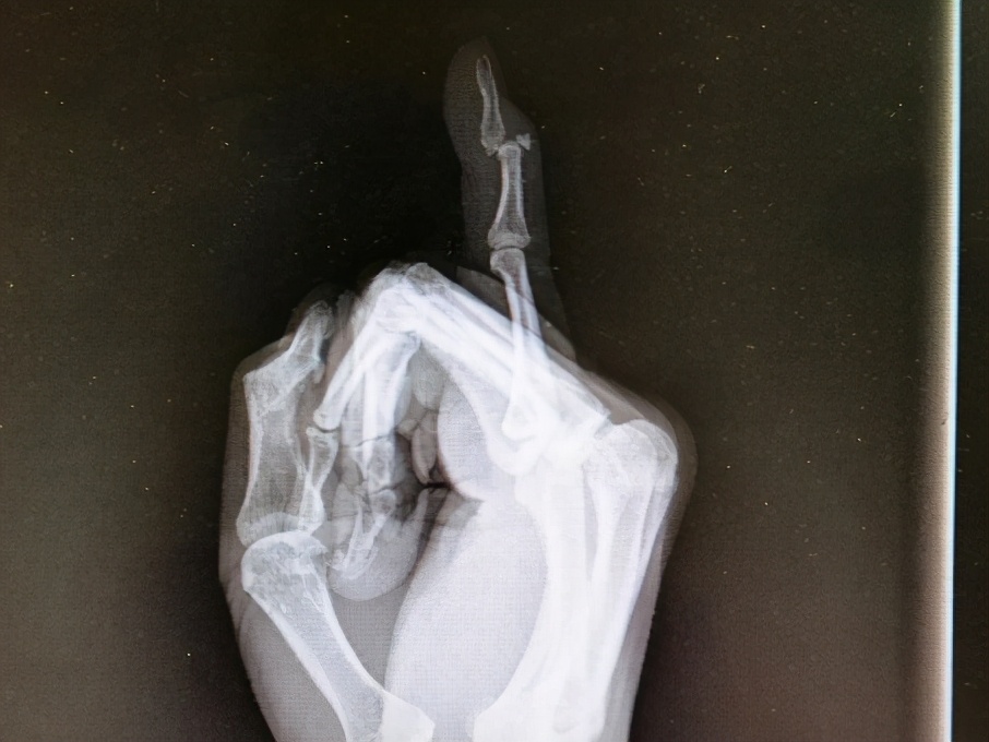 打篮球时手指戳到球了该怎么办,手指被篮球戳了怎么一直疼