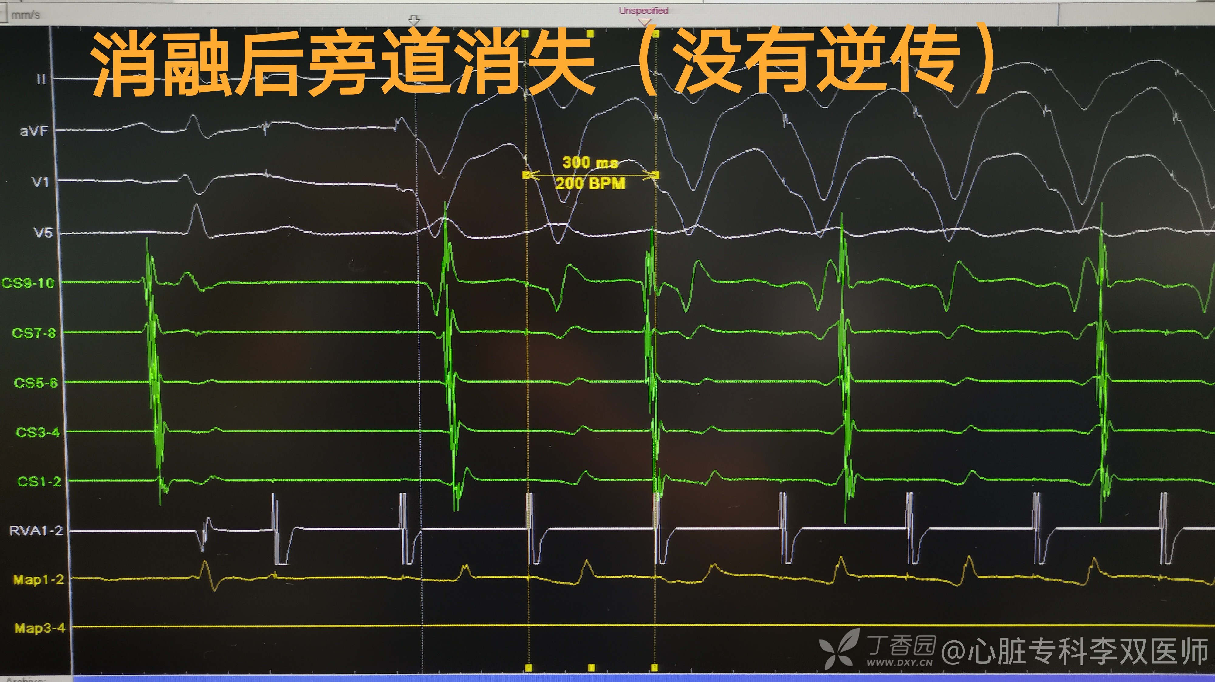 缁欒繙鍦ㄤ粬涔＄殑缃戝弸鎯呬功,缁欒繙鍦ㄤ粬涔＄殑缃戝弸瀵勪粈涔堢ぜ鐗╁ソ