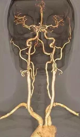 面神经分布图片大全,怎么记住面神经分布