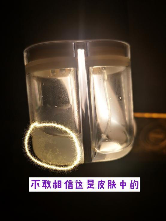 给男朋友第一次用黑头仪,皮肤居然这么脏,用完直呼:陈冠希