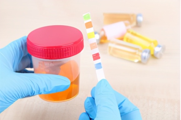 尿频？少尿？颜色异常？气味难闻？可能是4种疾病信号