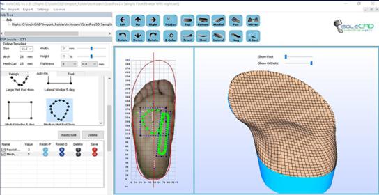 权健正骨鞋垫,权健鞋垫哪里还有卖的