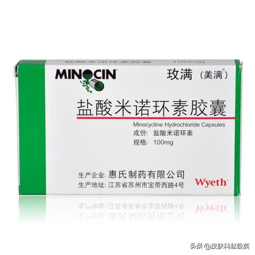 不同类型痘痘治疗药膏,治疗痘痘最有效的方法是什么