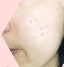 包文婧推荐祛痘,包文婧推荐护肤套装