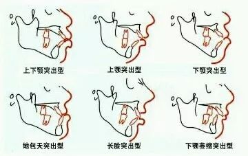 错过青春又如何,错过生长发育期怎么办