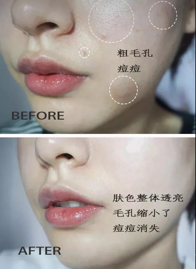 沈梦辰素颜公开惊呆了众多网友,沈梦辰颜值巅峰有多美