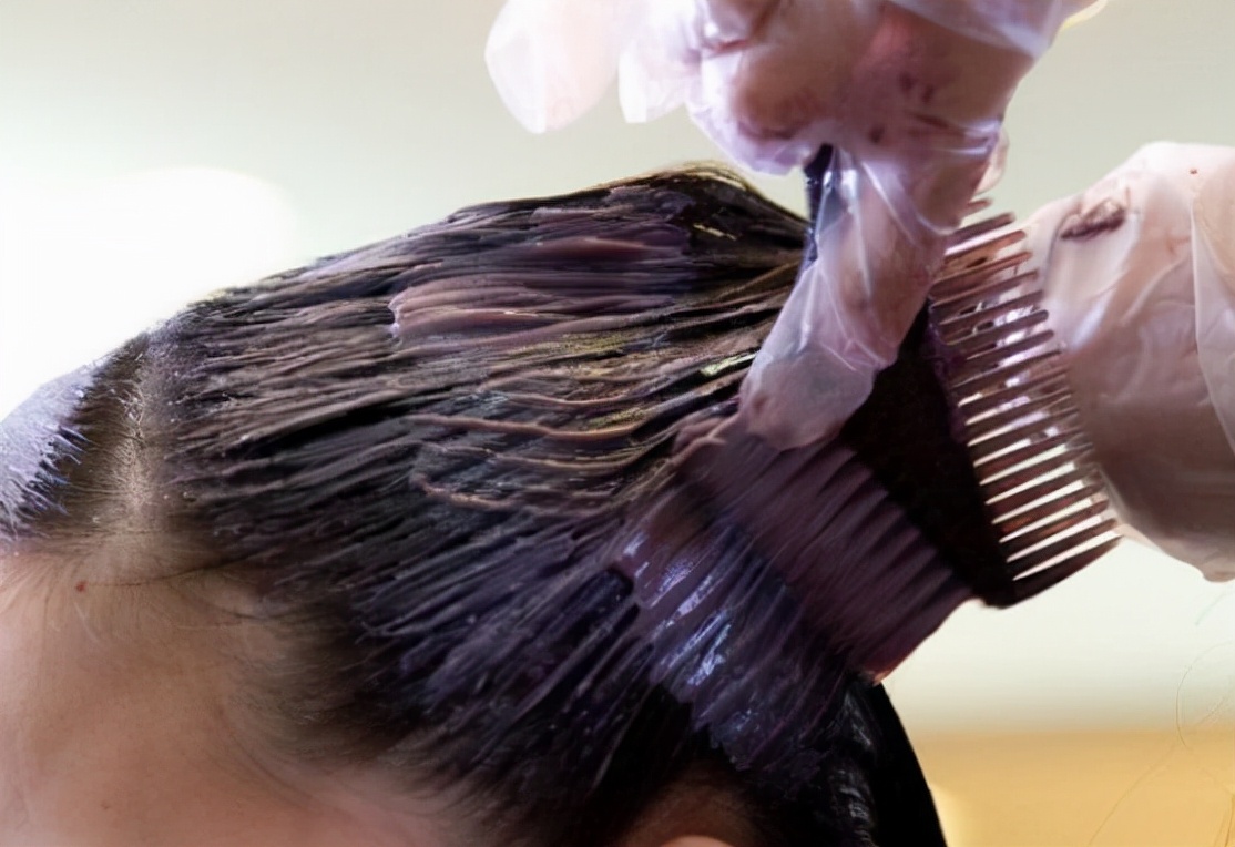 “发量过少、白发增多”，该怎么办？注意以下几点或可得到改善