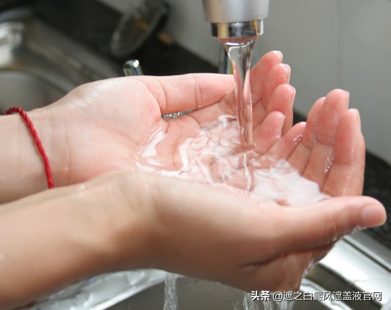 白癜风洗脸有什么忌讳,白癜风怎么清洁